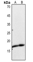 Histone H3 (Acetyl-K23) Antibody