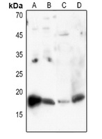 Histone H3 (Acetyl-K27) Antibody