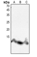 Histone H4 (Acetyl-K8) Rabbit Polyclonal Antibody