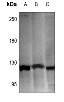 Hexokinase 1 Rabbit Polyclonal Antibody