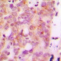 HLA-H Rabbit Polyclonal Antibody