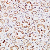 IGFBP3 Antibody