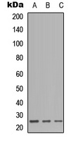 CD179b Rabbit Polyclonal Antibody