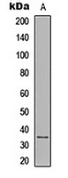 IL-12A Antibody