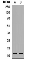 IL-1F5 Antibody