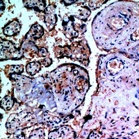 Inhibin alpha Rabbit Polyclonal Antibody