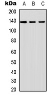 SHIP2 Rabbit Polyclonal Antibody