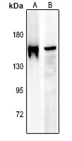 IRS1 (Phospho-S636) Rabbit Polyclonal Antibody