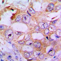 IRS1 (Phospho-S636) Rabbit Polyclonal Antibody