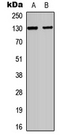 CD103 Rabbit Polyclonal Antibody