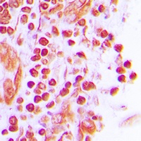 JUNB Rabbit Polyclonal Antibody