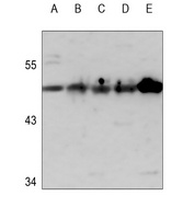 Cytokeratin 14 Rabbit Polyclonal Antibody