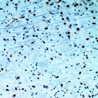 Cytokeratin 14 Rabbit Polyclonal Antibody