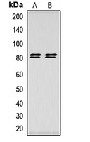 HSL (Phospho-S552) Rabbit Polyclonal Antibody
