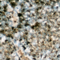 HSL (Phospho-S552) Rabbit Polyclonal Antibody