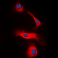 LT beta Rabbit Polyclonal Antibody