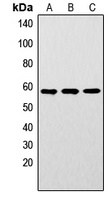 LYN (Phospho-Y192) Rabbit Polyclonal Antibody
