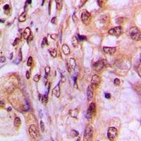 MAF1 Rabbit Polyclonal Antibody