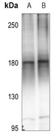 MEKK4 Rabbit Polyclonal Antibody