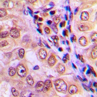 MEKK4 Rabbit Polyclonal Antibody