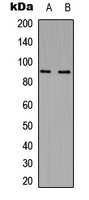 MARK2 Rabbit Polyclonal Antibody