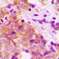 MARK2 Rabbit Polyclonal Antibody