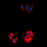 MARK2 Rabbit Polyclonal Antibody
