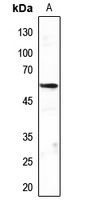 MEF2C Rabbit Polyclonal Antibody