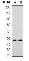 MRPS5 Rabbit Polyclonal Antibody
