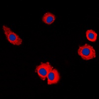 MUC16 Antibody