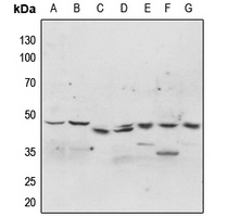 p47 phox (Phospho-S304) Rabbit Polyclonal Antibody