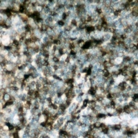 p47 phox (Phospho-S304) Rabbit Polyclonal Antibody