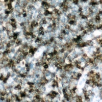 p47 phox (Phospho-S328) Rabbit Polyclonal Antibody