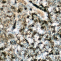 p47 phox (Phospho-S359) Rabbit Polyclonal Antibody