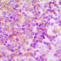 p40 phox Rabbit Polyclonal Antibody