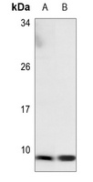 NDUFA3 Rabbit Polyclonal Antibody