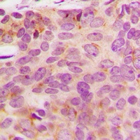 NDUFA3 Rabbit Polyclonal Antibody