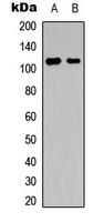 NFAT4 (Phospho-S165) Rabbit Polyclonal Antibody