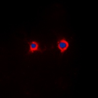 NFAT4 (Phospho-S165) Rabbit Polyclonal Antibody