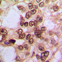 NF-kappaB p105/p50 (Phospho-S337) Antibody