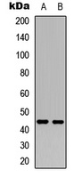 NR2F2 Rabbit Polyclonal Antibody