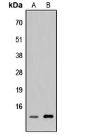 p311 Rabbit Polyclonal Antibody