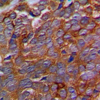 p311 Rabbit Polyclonal Antibody