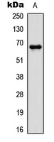 PAK1 (Phospho-T212) Rabbit Polyclonal Antibody