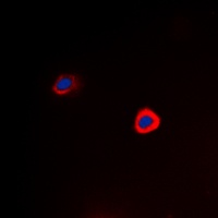 PAK1 (Phospho-T212) Rabbit Polyclonal Antibody