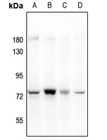 PARP3 Rabbit Polyclonal Antibody