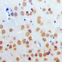 PARP3 Rabbit Polyclonal Antibody