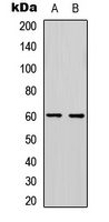 PDCD4 (Phospho-S457) Antibody