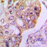 PDHA1 Rabbit Polyclonal Antibody
