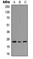 PEX11G Rabbit Polyclonal Antibody